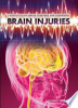 Brain_injuries