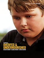Overfed___undernourished
